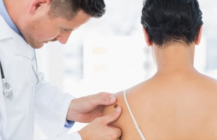 Doctor Examining Melanoma On Woman