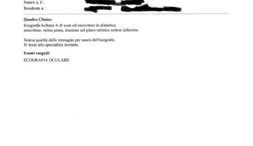 REFERTO1