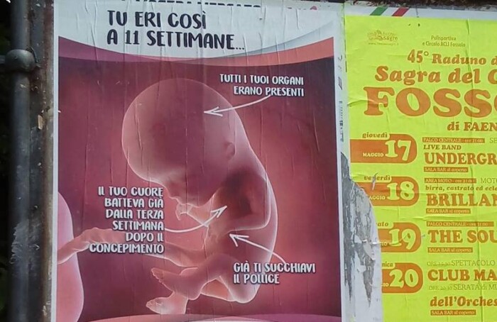 Pro Life