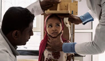 Una delle foto del reportage in Yemen con cui Lorenzo Tugnoli ha vinto il Pulitzer e il World Press Photo. Una bimba di 10 anni visitata in una clinica di Aslam: è denutrita ma non ancora in pericolo di vita e quindi non può essere ricoverata (Dicembre 2018, credit Washington Post/Contrasto)