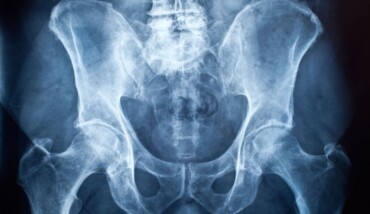 Radiografia