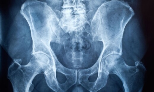 Radiografia