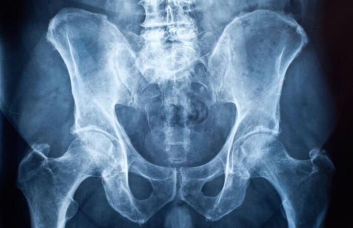Radiografia