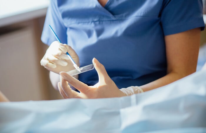 Lettura Pap Test