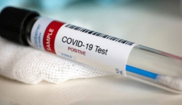 Coronavirus Tampone