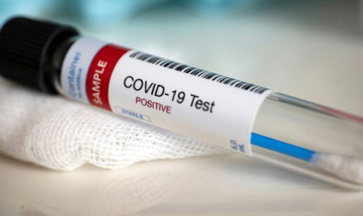 Coronavirus Tampone