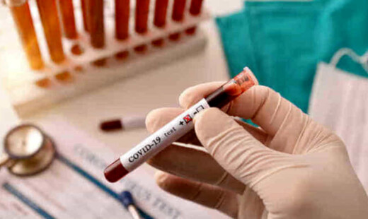 Covid 19 Provetta Sangue Test Sierologici 2 2
