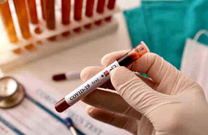 Covid 19 Provetta Sangue Test Sierologici 2 2