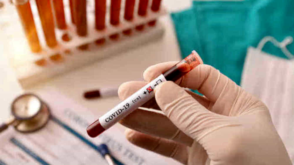 Covid 19 Provetta Sangue Test Sierologici 2 2