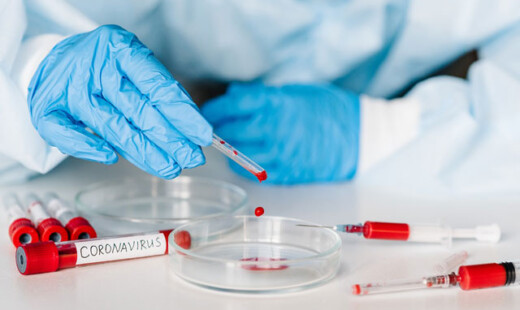 Coronavirus Test Laboratori