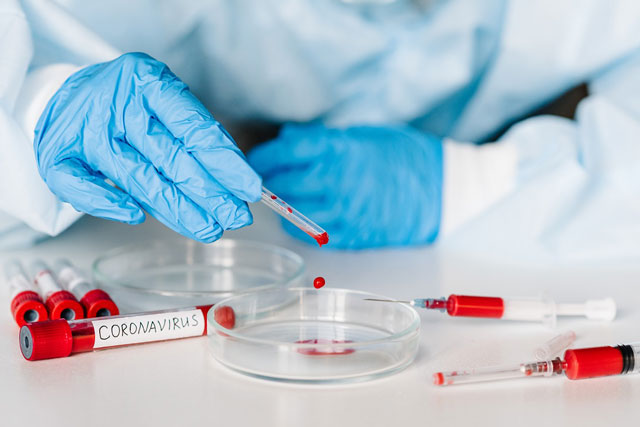 Coronavirus Test Laboratori