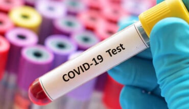 Test Sierologici Covid