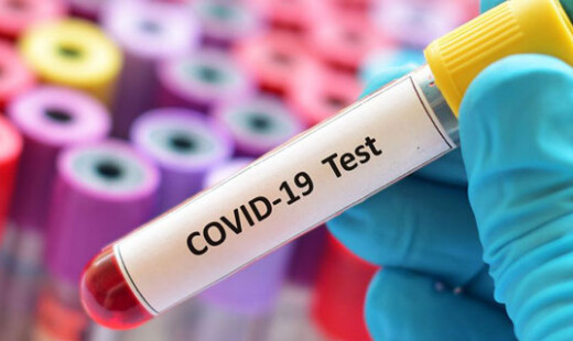 Test Sierologici Covid