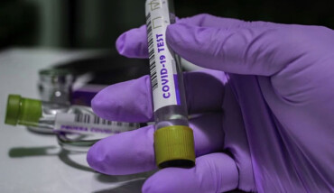 Coronavirus Test