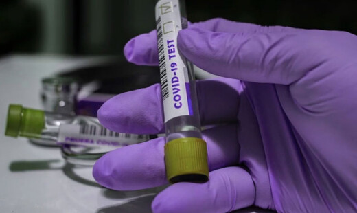 Coronavirus Test
