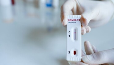 Test Sierologici Opt