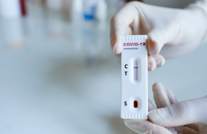 Test Sierologici Opt
