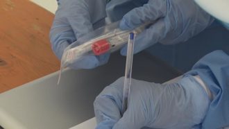 42 Virus010920 Covid Mascherina Tampone Tamponi 02