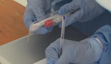 42 Virus010920 Covid Mascherina Tampone Tamponi 02