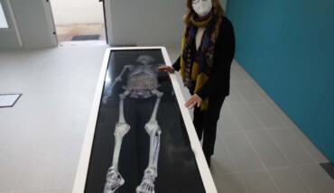 Ravenna Installato anotomage Table Per Medicina