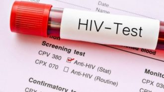 Hiv Test