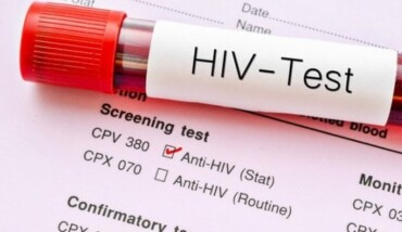 Hiv Test