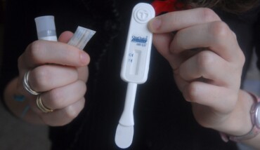 Test Rapido Hiv2