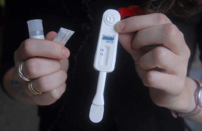 Test Rapido Hiv2