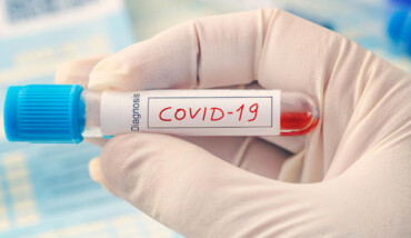 Tampone Covid Diagnosi