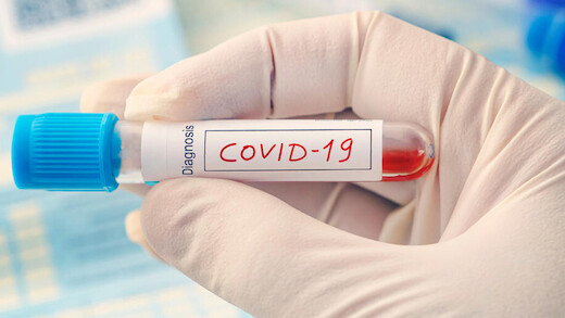 Tampone Covid Diagnosi