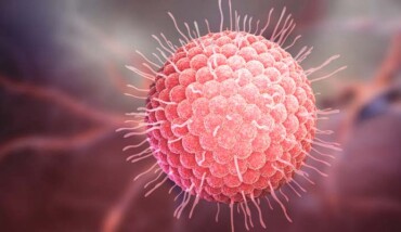 Herpes Zoster Virus 