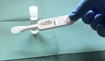Dispositivo Test Rapido HIV