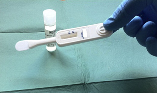 Dispositivo Test Rapido HIV
