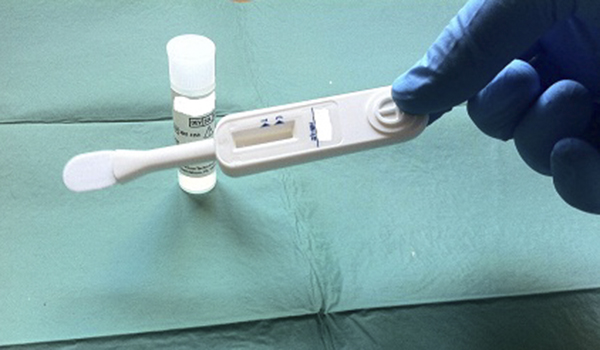 Dispositivo Test Rapido HIV