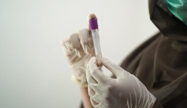 Esami Sangue