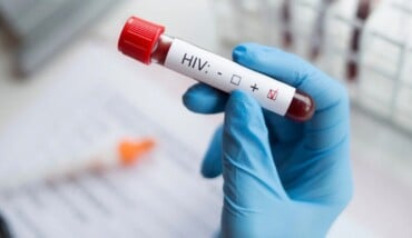 Hivtest