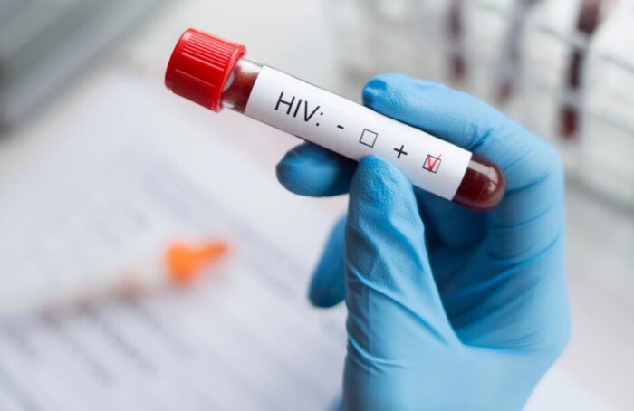 Hivtest