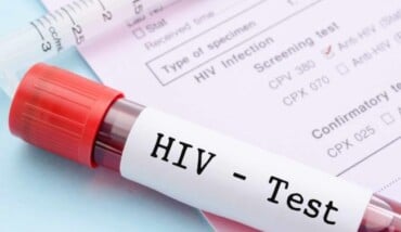 Hiv Test E1487073837125 1 
