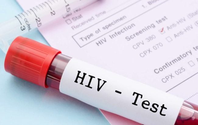 Hiv Test E1487073837125 1